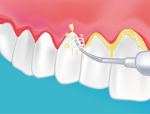 parodontie dentaire paris bourse